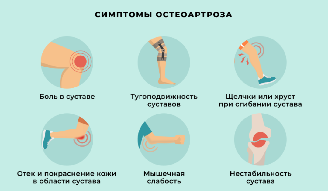 Клинические симптомы остеоартроза. Остеоартроз клинические проявления. Деформирующий остеоартроз клинические проявления. Основные клинические проявления остеоартроза.